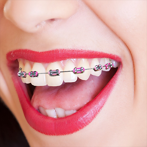 Braces Camera