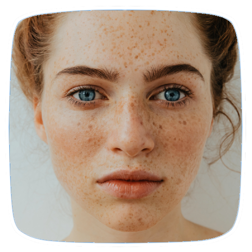 Freckles Home Remedies Tips